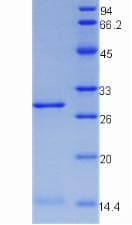 Mouse CD71 / Transferrin Receptor Protein (Recombinant His, N-Terminal)