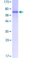 Human CKM / Creatine Kinase MM Protein (Recombinant GST)