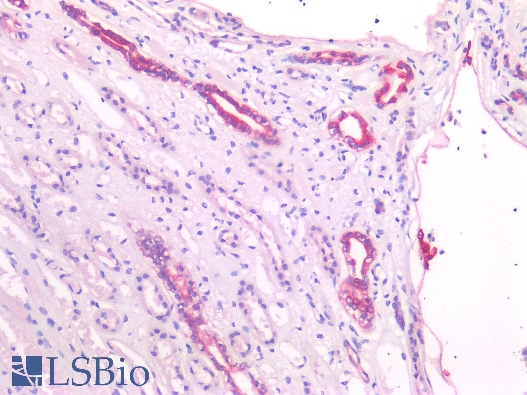 PathPlus™ Polyclonal Rabbit anti-Human UCHL1 / PGP9.5 Antibody (IHC)