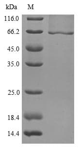 Mouse GBA / Glucosidase Beta Acid Protein (Recombinant 6His, N-terminus)