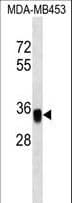 EPCAM Antibody (aa200-229)