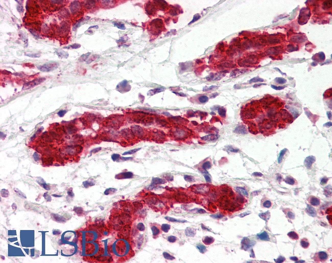 PathPlus™ PDCD4 Antibody (aa1-469, clone K4C1)