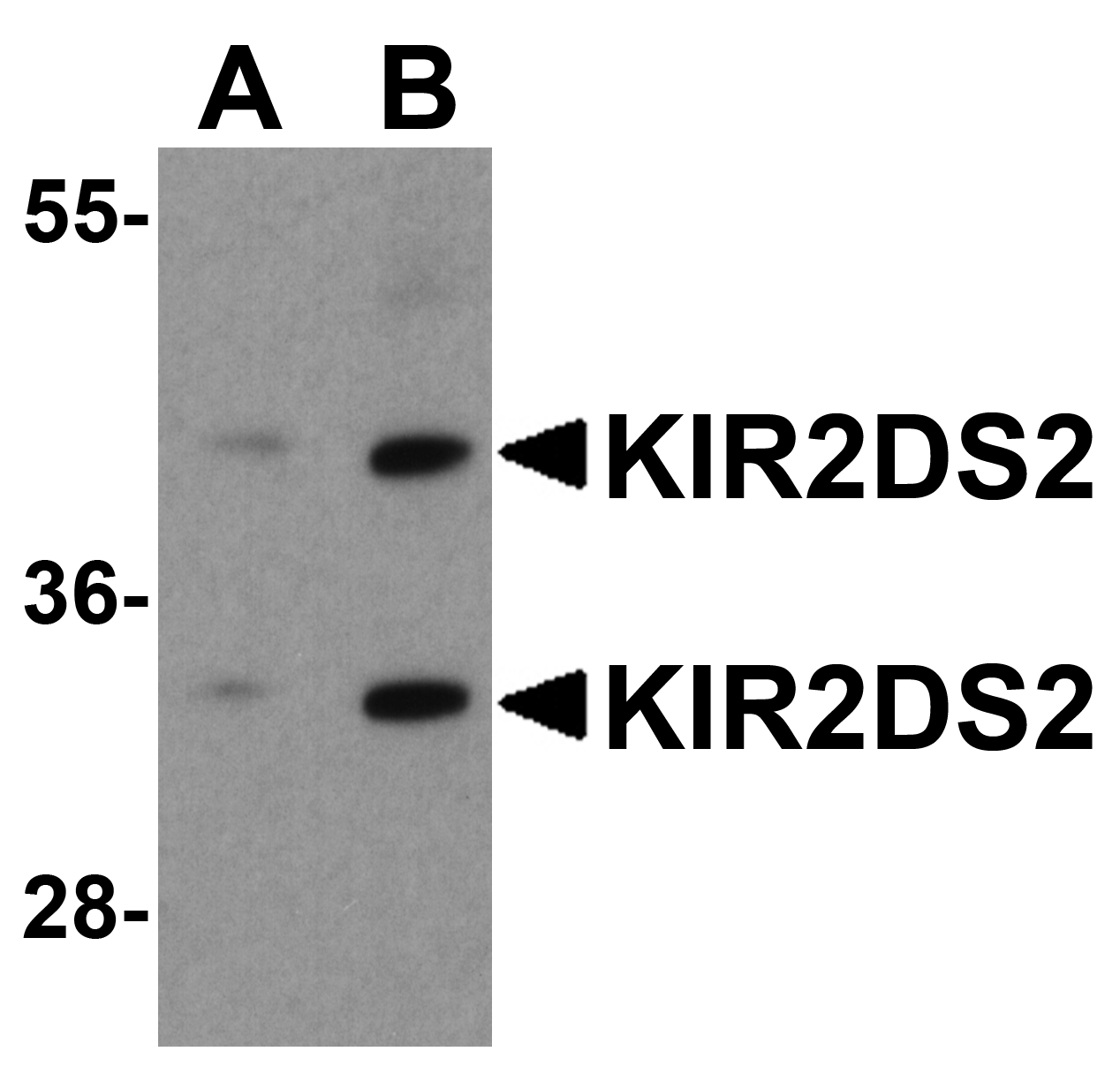 Polyclonal Rabbit anti-Human KIR2DS2 / CD158j Antibody (IF, WB)