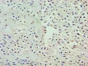 Polyclonal Rabbit anti-Human GRB7 Antibody (aa233-532, IHC)