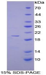Human DISC1 Protein (Recombinant His-T7)