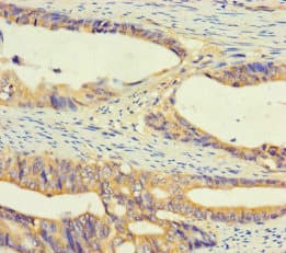 Polyclonal Rabbit anti-Human UGT2A3 Antibody