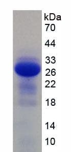 Mouse IL2RB / CD122 Protein (Recombinant His, N-Terminal)