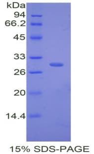 Mouse CFD / Factor D / Adipsin Protein (Recombinant His)