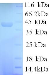 Human SYN1 / Synapsin 1 Protein (Recombinant His)