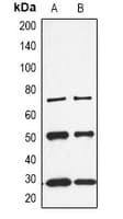 Polyclonal Rabbit anti-Human CALB1 / Calbindin Antibody (C-Terminus, WB)