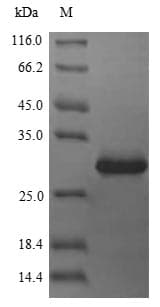Human CDKN3 / KAP Protein (Recombinant 6His, N-terminus)