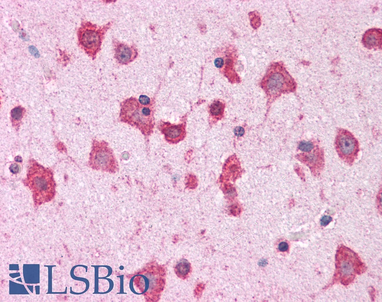 IHC-plus™ Polyclonal Rabbit anti-Human DLGAP4 Antibody (IHC, WB)