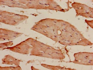 Polyclonal Rabbit anti-Human CDKAL1 Antibody (IHC, IF)