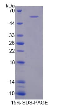 Mouse PLEKHA1 Protein (Recombinant His-GST)