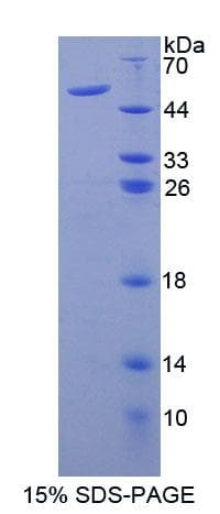 Mouse AUP1 Protein (Recombinant His-GST)