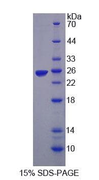 Chicken Leptin Protein (Recombinant His-S, N-terminus)