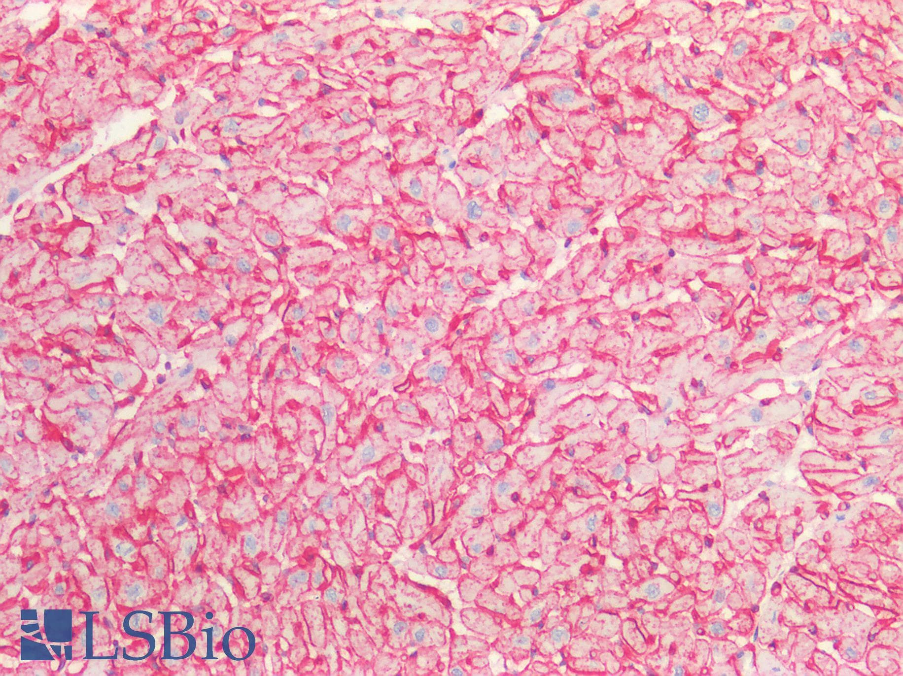 PathPlus™ CAV1 / Caveolin 1 Antibody (aa1-104)