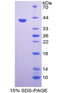 Bovine PTH / Parathyroid Hormone Protein (Recombinant His-GST)