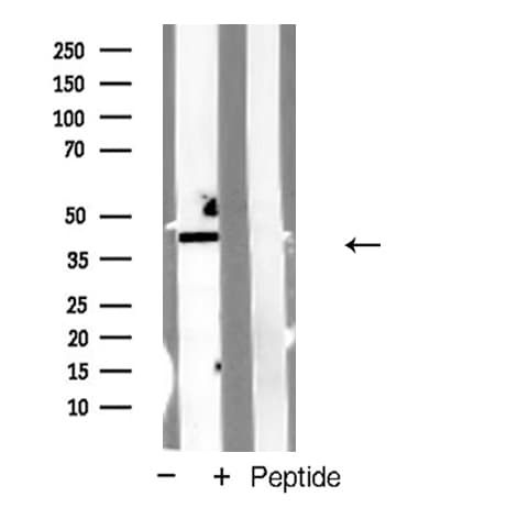 Polyclonal Rabbit anti-Human CYSLTR1 / CYSLT1 Antibody (IF, WB)