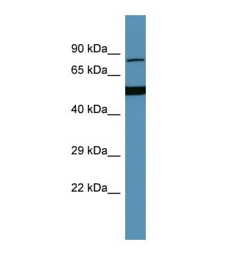 HGFAC / HGFA Antibody (aa559-608)