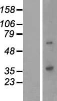 QPCTL Protein (Over-Expression Lysate Myc-DDK (Flag))