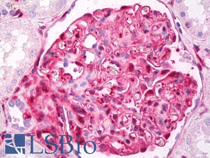 IHC-plus™ LGALS1 / Galectin 1 Antibody