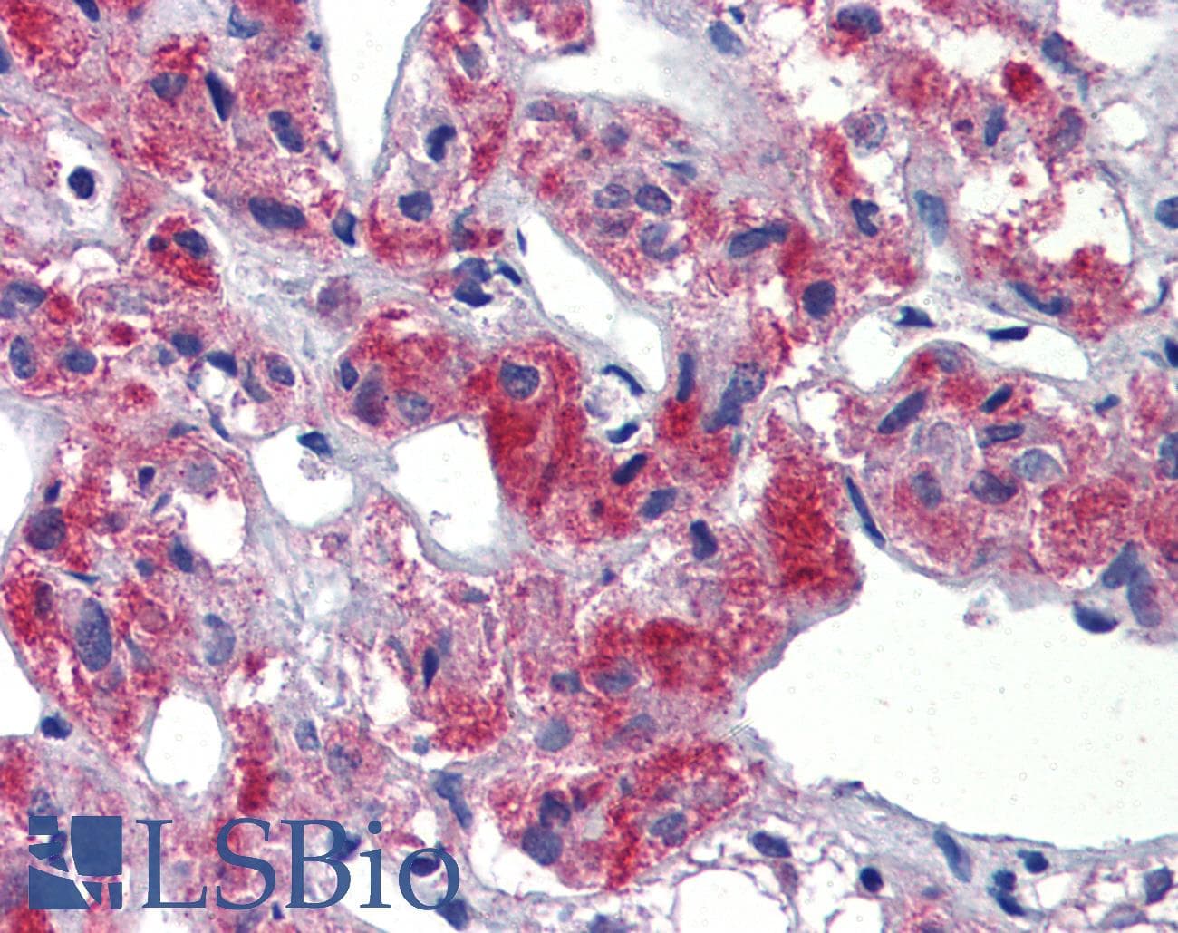 Polyclonal Rabbit anti-Human TAL1 Antibody (C-Terminus, IHC, WB)