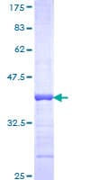 Human FGF9 Protein (Recombinant GST, N-terminus)