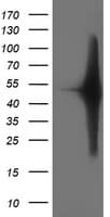 SETD7 / SET7 Antibody (clone OTI2D10)