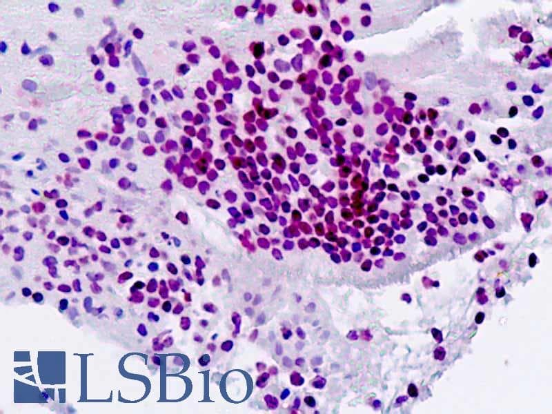 IHC-plus™ SPI1 / PU.1 Antibody (aa217-246)