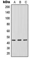 Polyclonal Rabbit anti-Human IDO1 / IDO Antibody (Internal, WB)