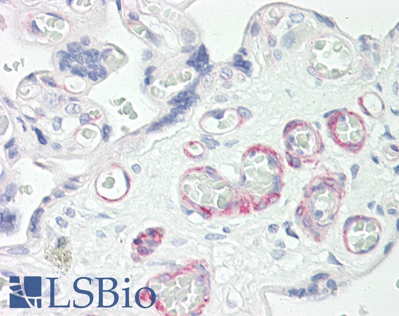 ZNF322 Antibody (C-Terminus)