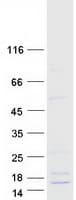 Human DEFB121 Protein (Recombinant Myc-DDK (Flag))