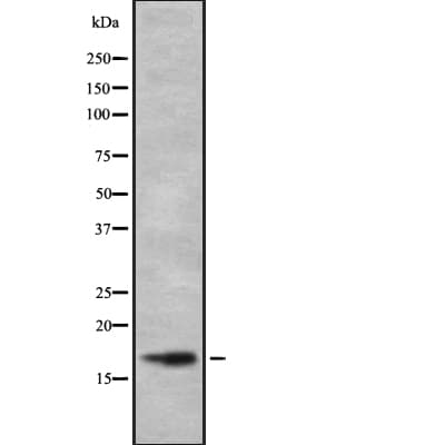 UBE2L3 / UBCH7 Antibody