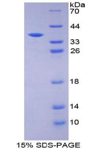 Mouse EIF2AK2 / PKR Protein (Recombinant His, N-Terminal)