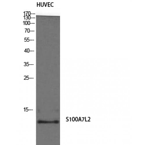 S100A7L2 Antibody (10-90 aa, Internal)