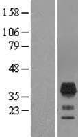 TMEM163 Protein (Over-Expression Lysate Myc-DDK (Flag))