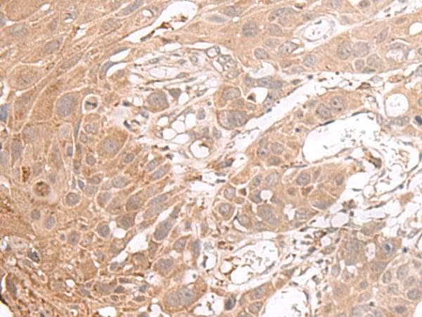 CHST4 / GlcNAc6ST2 Antibody