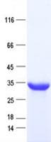 Human CDCA4 Protein (Recombinant His, N-Terminal)