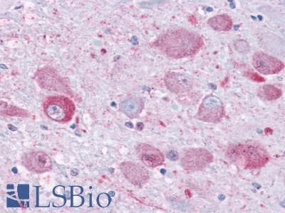 IHC-plus™ Polyclonal Rabbit anti-Human NPY1R Antibody (Cytoplasmic Domain, IHC)
