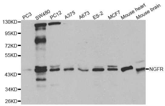 Polyclonal Rabbit anti-Human NGFR / CD271 / TNR16 Antibody (WB)