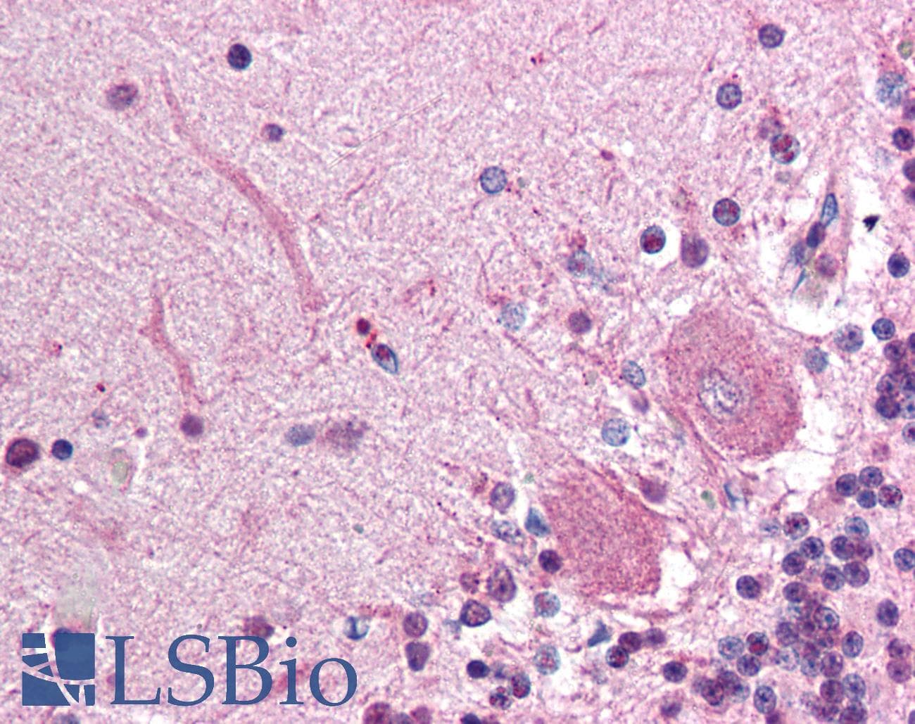 IHC-plus™ Polyclonal Rabbit anti-Human PLTP Antibody (IHC, WB)