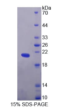 Human SMARCA3 / HLTF Protein (Recombinant His-T7)