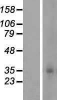 Human OR5F1 Protein (Over-Expression Lysate Myc-DDK (Flag))