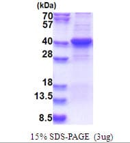 Human LIPG / Endothelial Lipase Protein (Recombinant His)