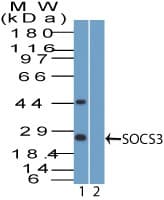SOCS3 Antibody
