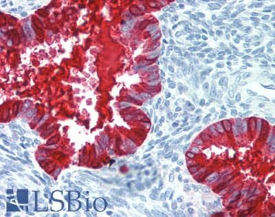 IHC-plus™ Polyclonal Rabbit anti-Human PAEP / Glycodelin / GdF Antibody (IHC, IF, WB)