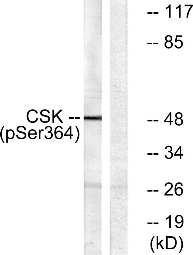 Polyclonal Rabbit anti-Human c-Src Kinase / CSK Antibody (phospho-Ser364, WB)