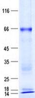 Human ZNF221 Protein (Recombinant His, N-Terminal)