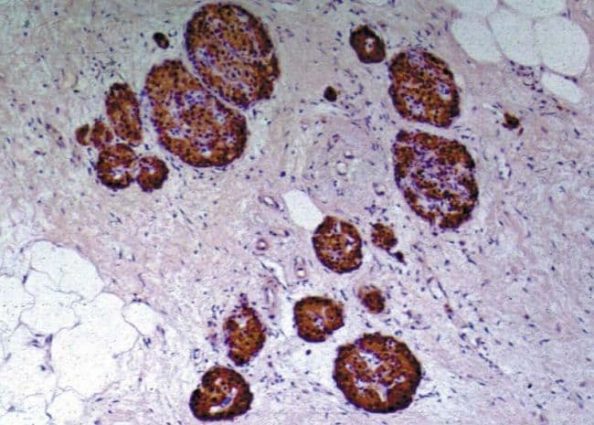 Insulin C-Peptide Antibody (clone C-PEP-01)